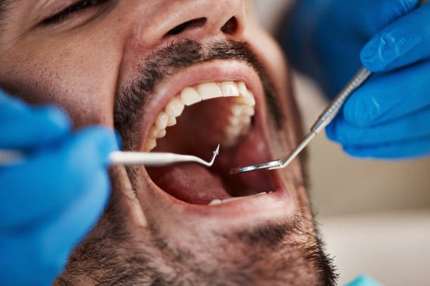 Emergency Dental Services in Mars, PA